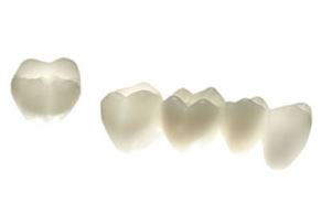 zirlux full contour zirconia