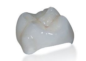 ips emax crowns